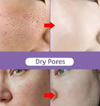 Transform Your Skin with The Beautikin Glow & Restore Bundle