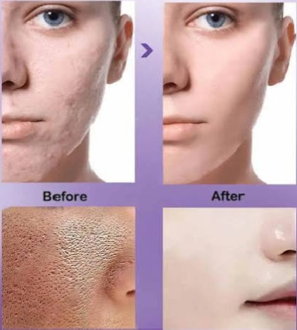 🧴 Beautikin 3-In-1 Skincare Set – Facewash, Brightening Serum & Glow Cream | Own Your Glow